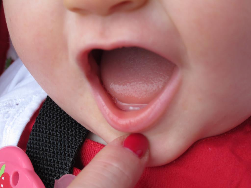 o ideal é iniciar a higiene bucal assim que inicia-se a introdução alimentar ou no nascimento do primeiro dentinho
