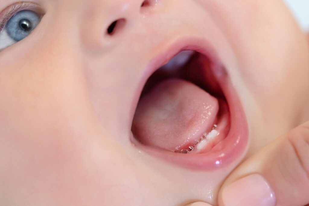 dentes de um bebe